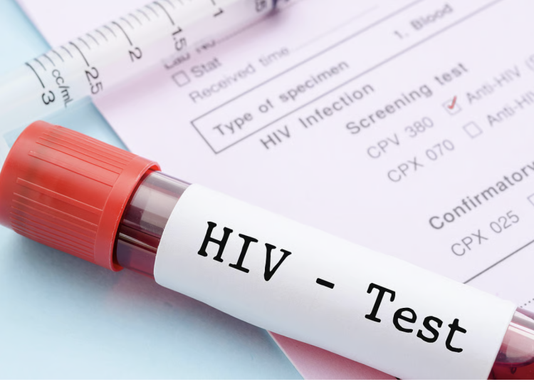 hiv